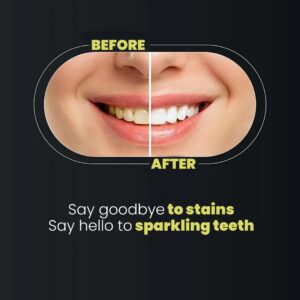 Teeth Whitening Strips 3D Gentle Stain Removing Enamel Safe Bright Smile Daily