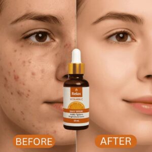 Relax Vitamin C Daily Serum – Brightening & Anti-Aging Face Serum - 30ml