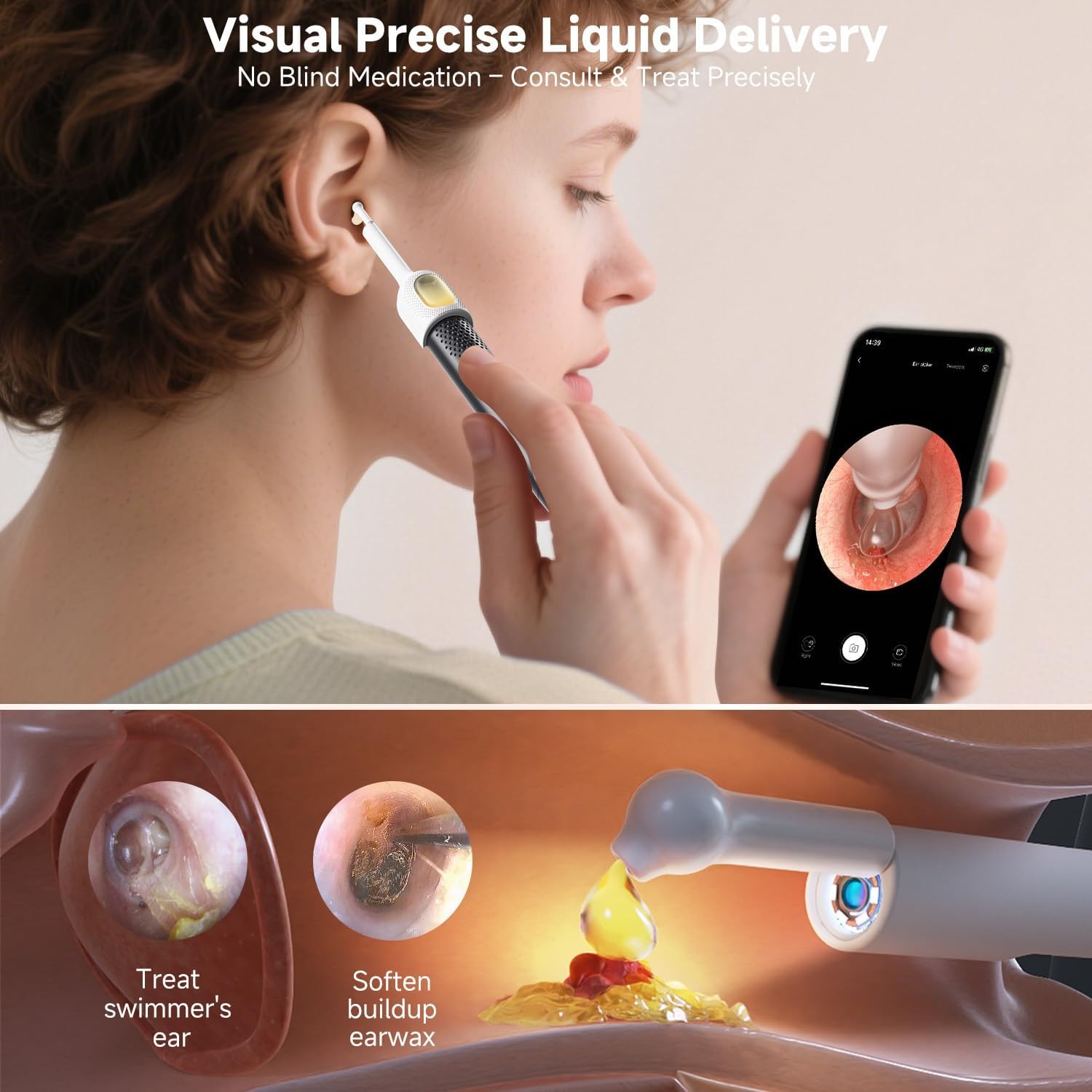 Rechargeable Smart Wireless Ear Camera Kit Visual Ear Wax Removal Tool - Image 4