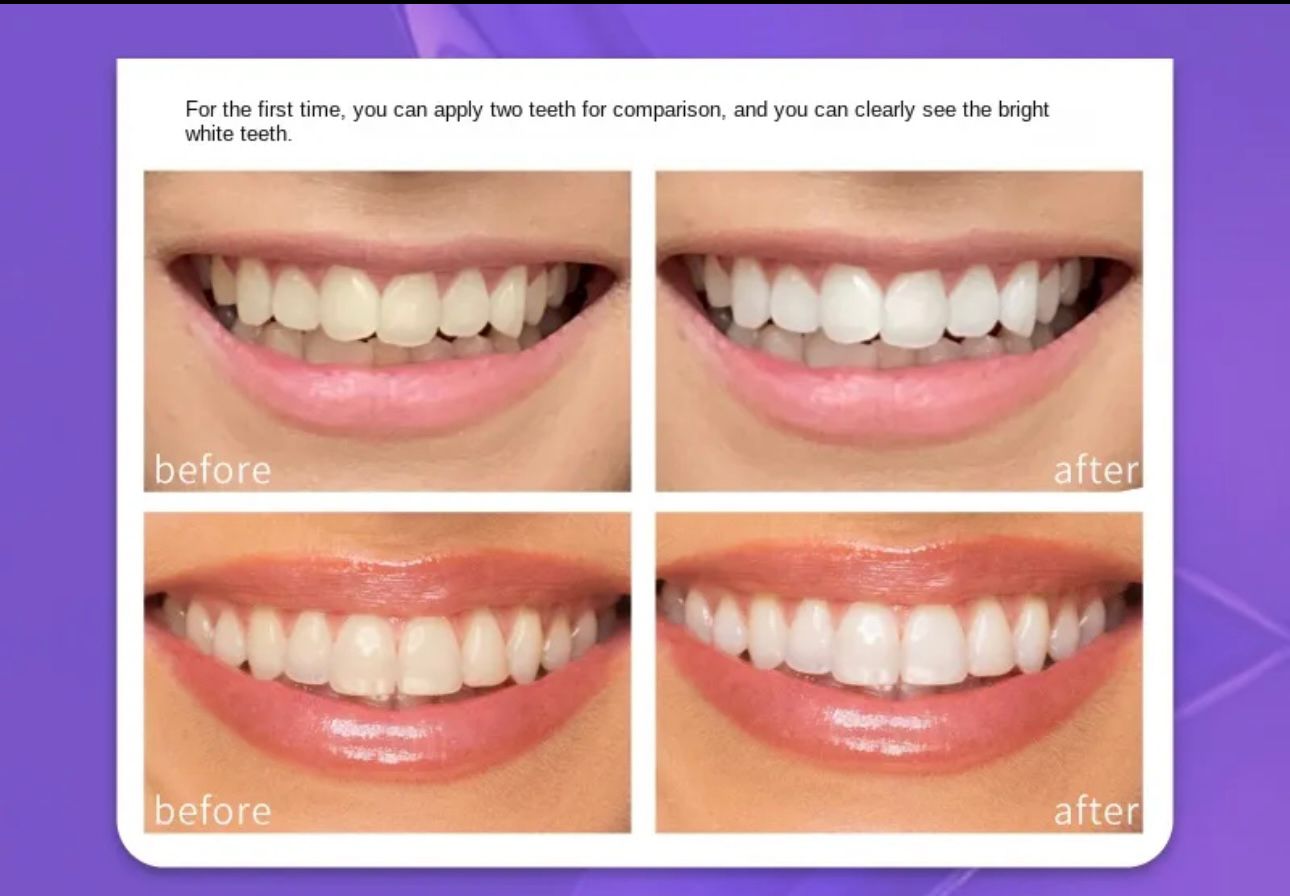 Teeth Brightening Hismiles V34 Colour Corrector Serum 30ml - Image 5